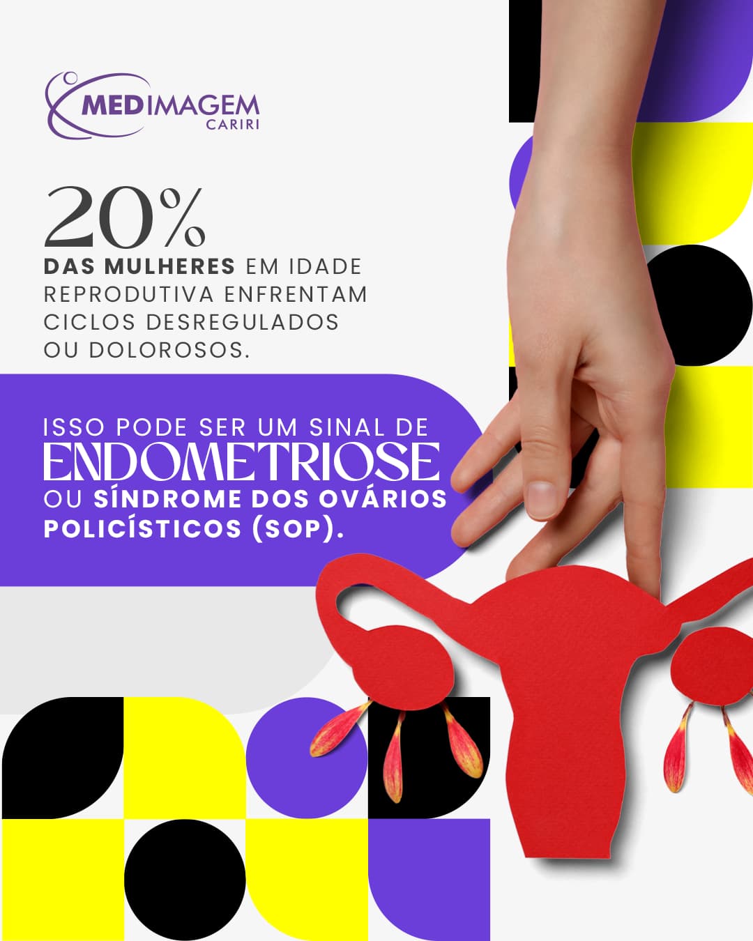Ciclo Menstrual Irregular