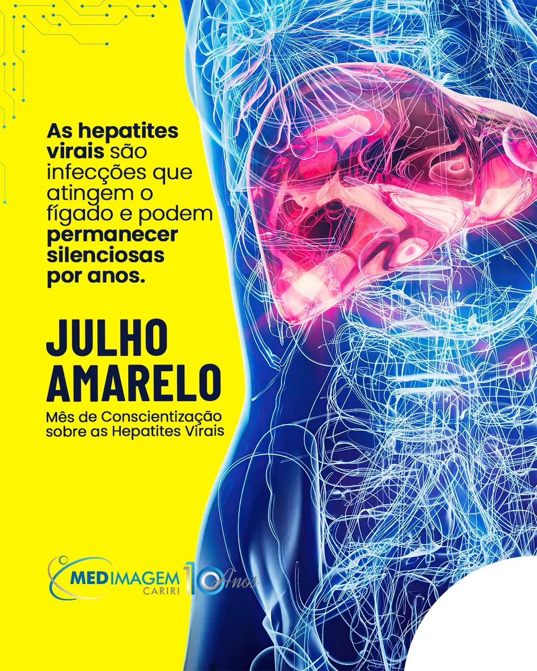 Julho Amarelo: cuidar do fígado
