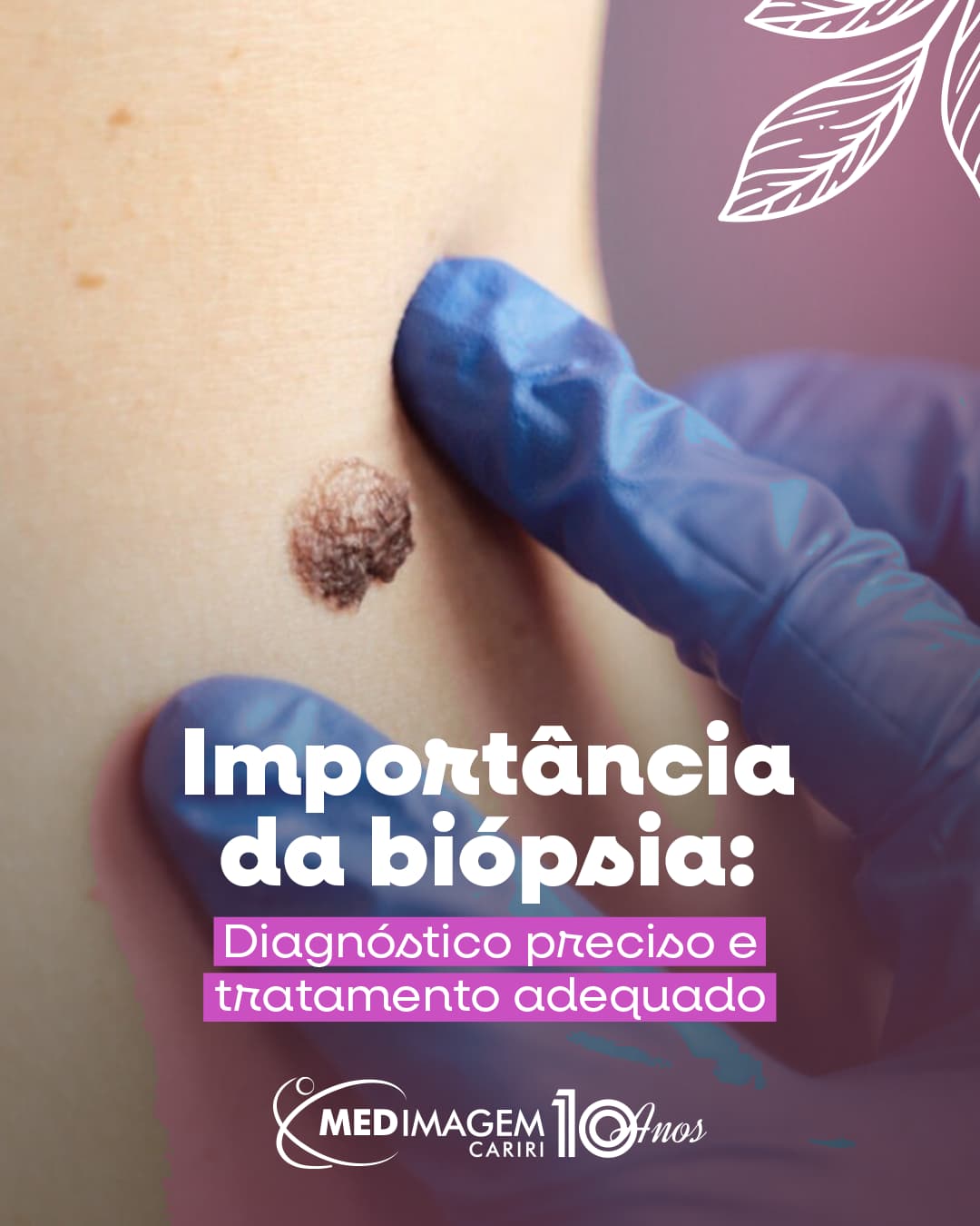 A Importância da Biópsia