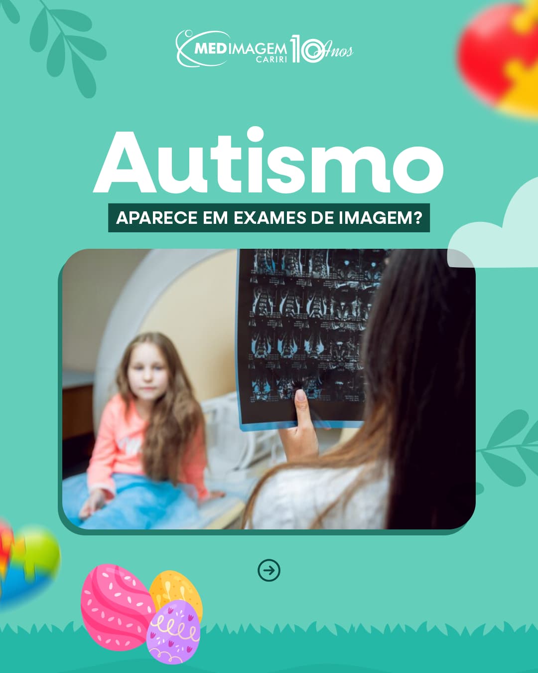 Autismo em Exames de Imagem
