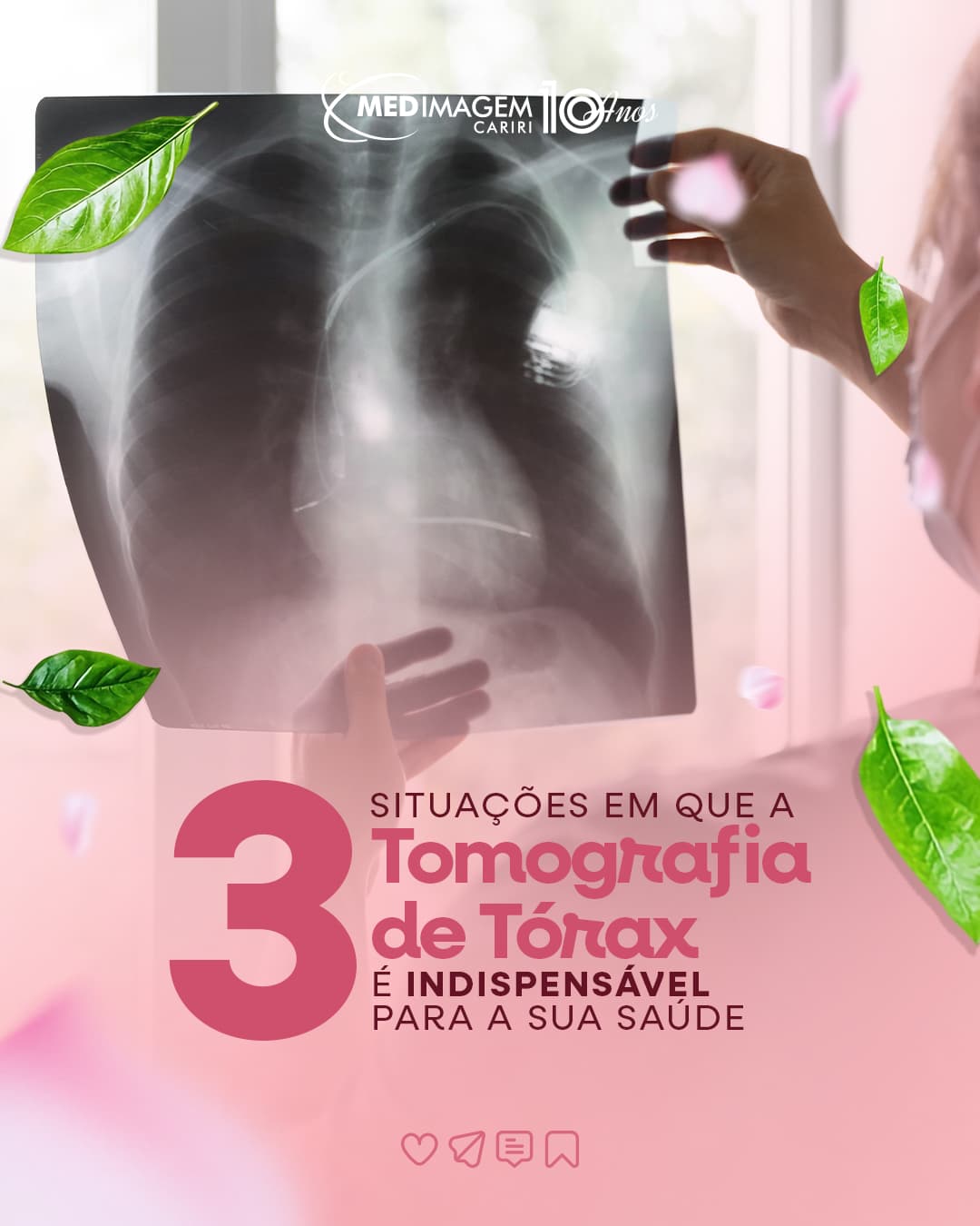 Tomografia de Tórax