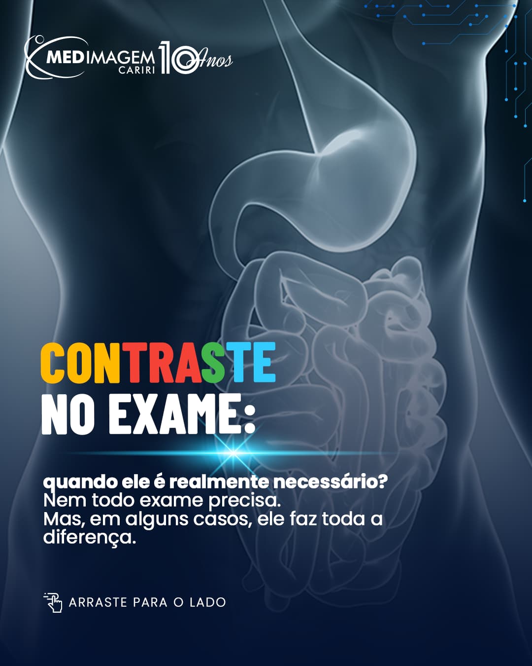 Contraste nos exames de imagem
